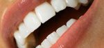 سفید کردن طبیعی دندان ها در خانه